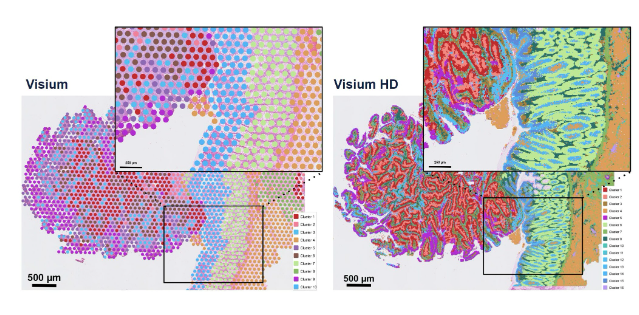Spatial Transcriptomics – From Statistical Foundations to Machine ...
